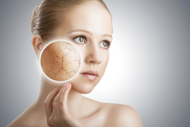 dry-skin