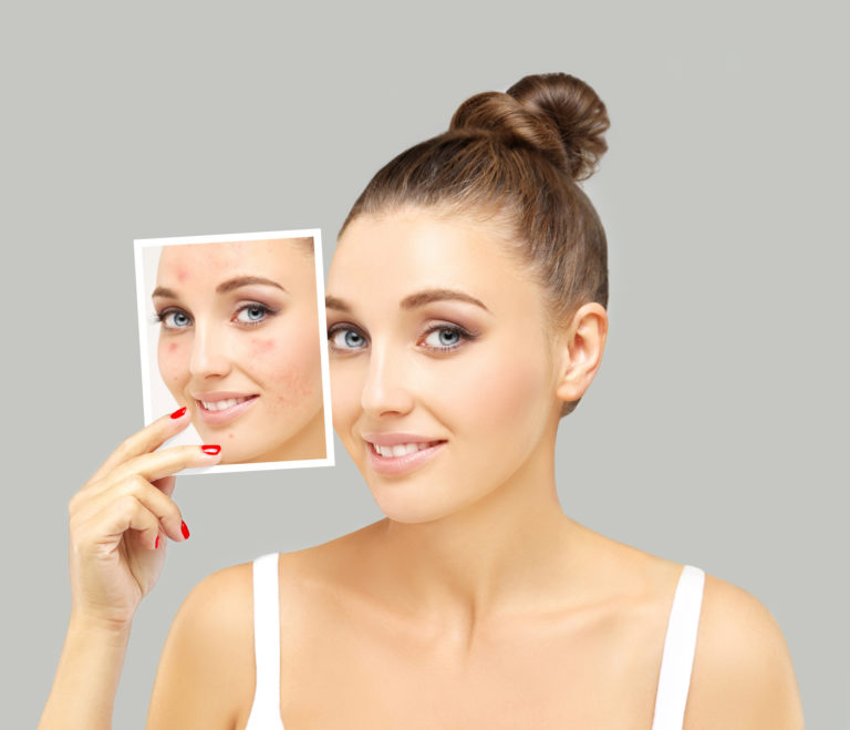 Gunilla’s Pro SkinCare Tip #3