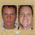 before and after