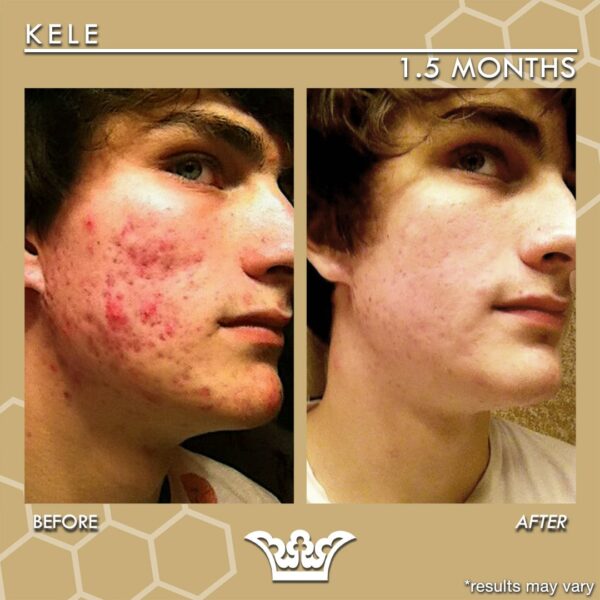 before and after