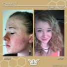 before & after