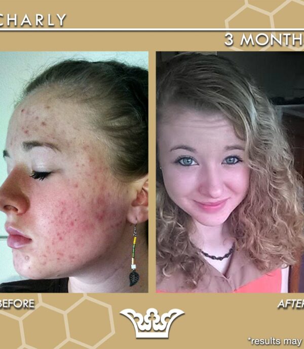 before & after