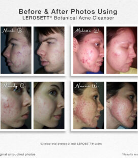before and after