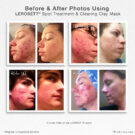 before and after