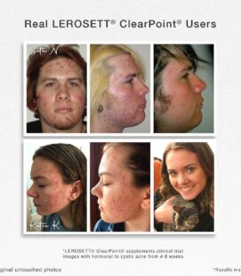 before and after
