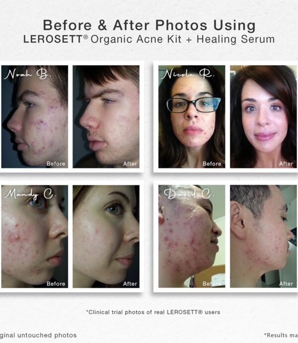 before & After