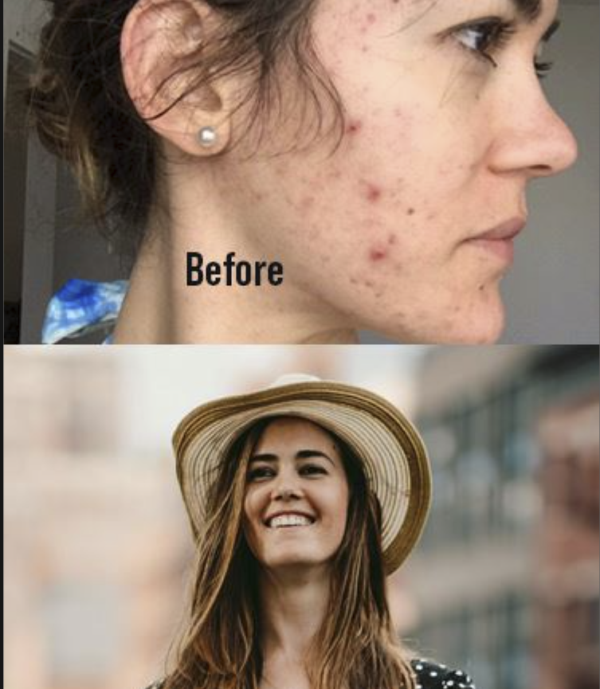 Lerosett healing serum before & after