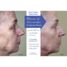 Bonnie-Before-After-Ceramide-Cream-1200x1200