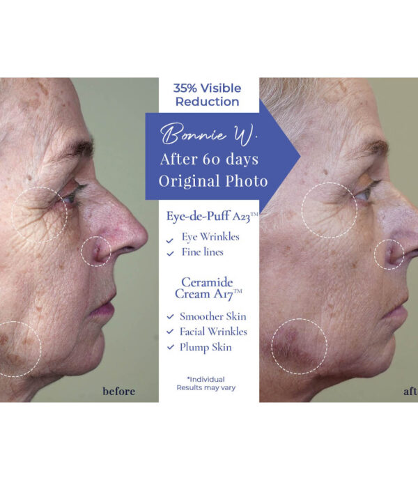 Bonnie-Before-After-Ceramide-Cream-1200x1200